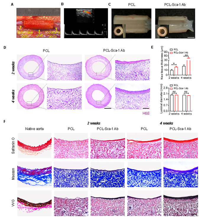 種抗體功能化修飾的人工血管通過(guò)選擇性捕捉血管干/祖細(xì)胞促進(jìn)組織再生