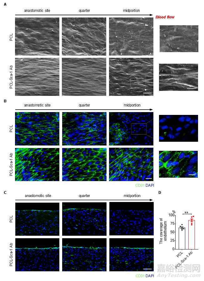 種抗體功能化修飾的人工血管通過(guò)選擇性捕捉血管干/祖細(xì)胞促進(jìn)組織再生