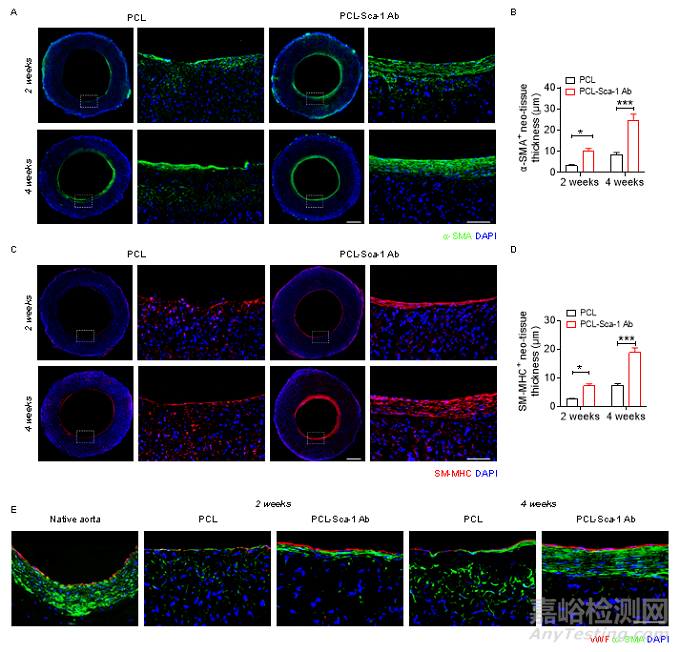 種抗體功能化修飾的人工血管通過(guò)選擇性捕捉血管干/祖細(xì)胞促進(jìn)組織再生