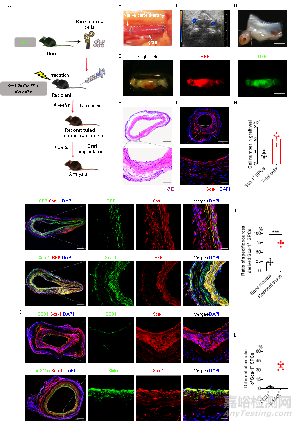 種抗體功能化修飾的人工血管通過(guò)選擇性捕捉血管干/祖細(xì)胞促進(jìn)組織再生