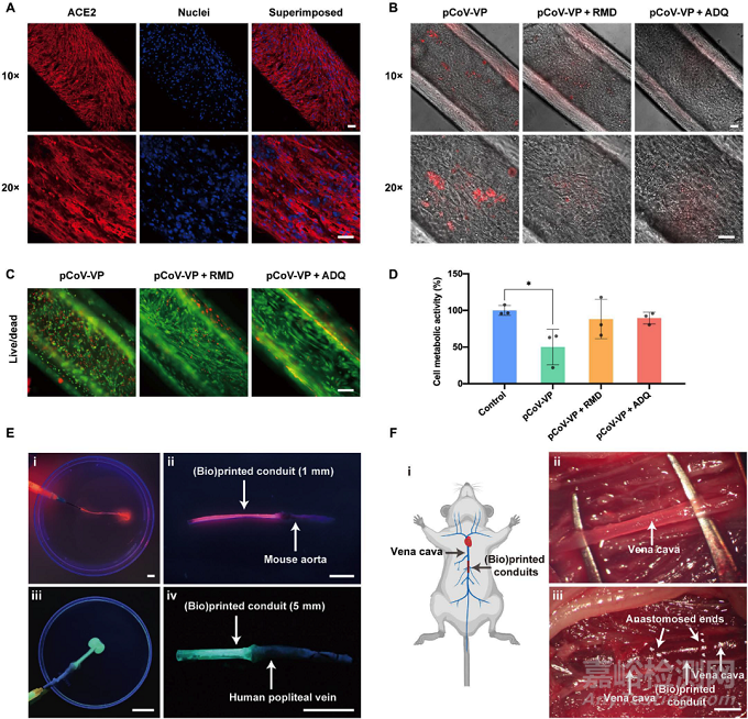 微流控同軸生物打印基于強韌水凝膠的功能化人工血管