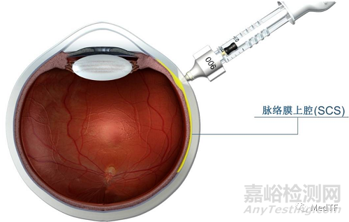 Prix Galien：Cala Trio獲得2022年“最佳醫(yī)療技術(shù)” 穿戴產(chǎn)品勝利日