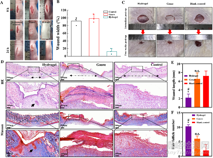 機(jī)械活性的水凝膠創(chuàng)可貼問世