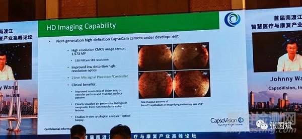 膠囊內(nèi)窺鏡的現(xiàn)狀與未來發(fā)展趨勢