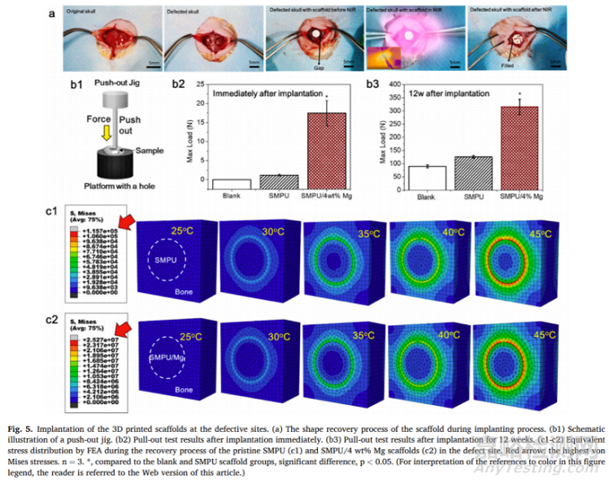 中科院：近紅外響應(yīng)性3D打印形狀記憶聚氨酯/鎂復(fù)合支架促進(jìn)骨再生
