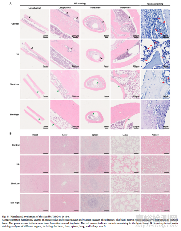 辛伐他汀涂層抗生物膜及內(nèi)植物感染并促進(jìn)骨整合