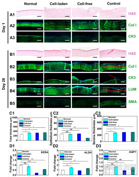 天津大學(xué):3D打印仿生上皮/基質(zhì)雙層水凝膠支架用于角膜再生