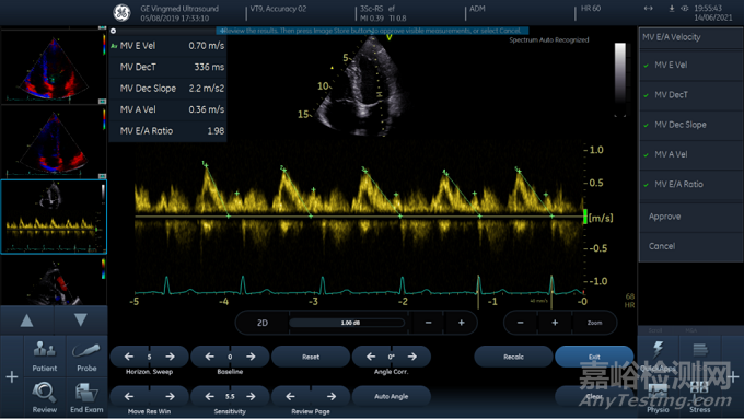 影像超聲流程優(yōu)化類人工智能軟件的應用及軟件確認思路探討