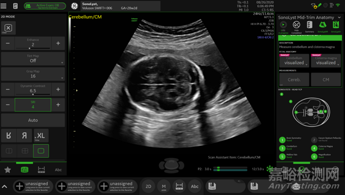 影像超聲流程優(yōu)化類人工智能軟件的應用及軟件確認思路探討
