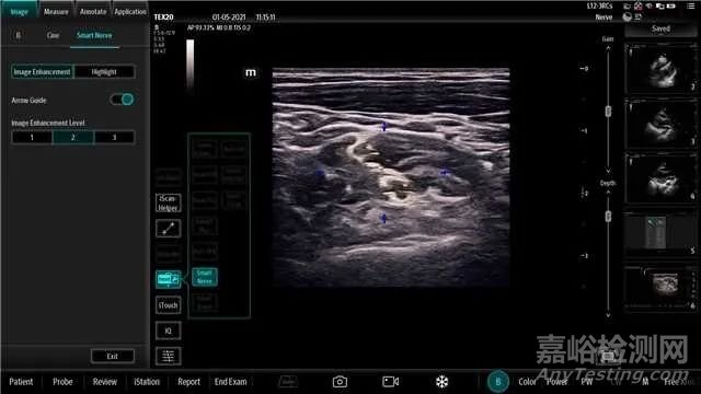 影像超聲流程優(yōu)化類人工智能軟件的應用及軟件確認思路探討