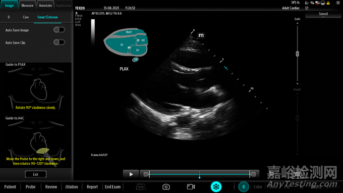 影像超聲流程優(yōu)化類人工智能軟件的應用及軟件確認思路探討