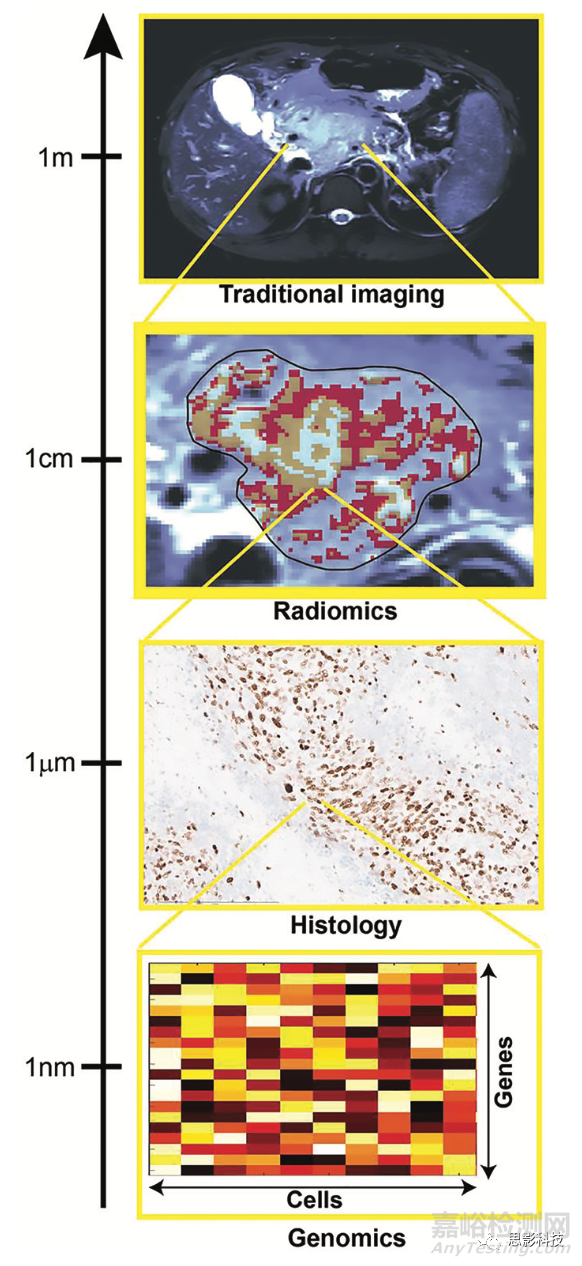 Radiology:影像組學(xué)特征的生物學(xué)意義