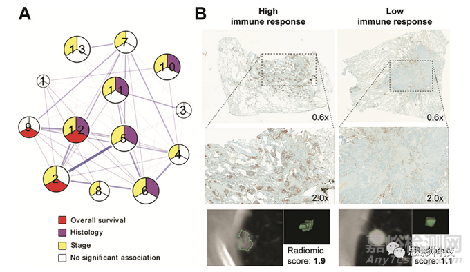 Radiology:影像組學(xué)特征的生物學(xué)意義
