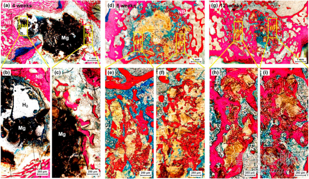 激光增材制造WE43可降解鎂合金骨植入物工藝優(yōu)化及體內(nèi)外生物降解行為