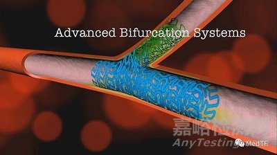 ABS:分叉的冠脈支架