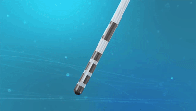 Vercise Genus:電刺激方向可控的腦起搏器