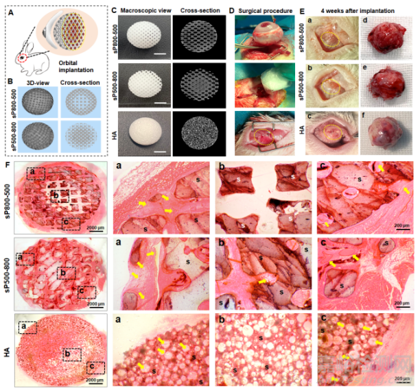 分級微孔結(jié)構(gòu)精細(xì)調(diào)控的抗感染型陶瓷義眼座設(shè)計及高效血管化整合研究