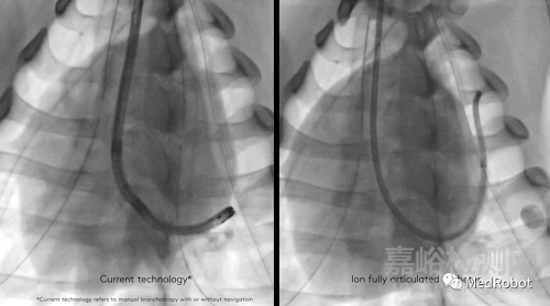盤點(diǎn)4款獲批的經(jīng)自然腔道手術(shù)機(jī)器人