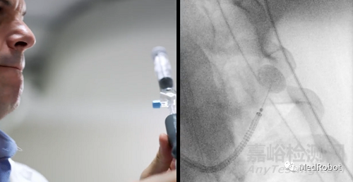 盤點(diǎn)4款獲批的經(jīng)自然腔道手術(shù)機(jī)器人