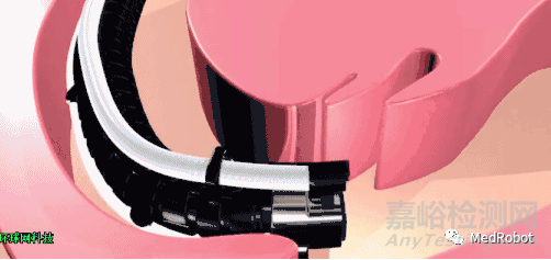 盤點(diǎn)4款獲批的經(jīng)自然腔道手術(shù)機(jī)器人