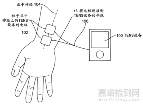 Cala Trio 可穿戴震顫治療儀被評為 2022 年最佳醫(yī)療設(shè)備創(chuàng)新