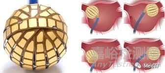 Globe PFA:具有標測功能的PFA完成首次臨床