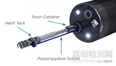 X-Tack:新一代消化內(nèi)鏡下大傷口止血神器