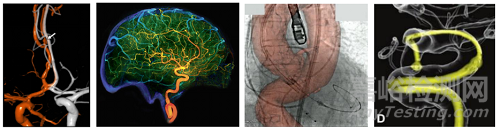 血管介入手術(shù)機器人:創(chuàng)新涌現(xiàn) 藍海市場 格局待定