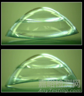 現(xiàn)代鞏膜鏡的設計特點及臨床應用