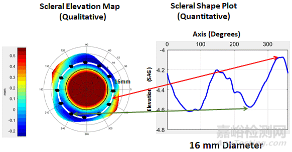現(xiàn)代鞏膜鏡的設計特點及臨床應用