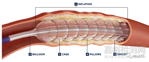 Chocolate Touch：藥涂巧克力球囊獲FDA批準(zhǔn)上市