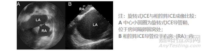 心腔內(nèi)超聲(ICE)行業(yè)市場(chǎng)分析