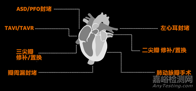 心腔內(nèi)超聲(ICE)行業(yè)市場(chǎng)分析