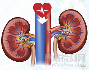 Verve：經(jīng)尿道腎盂去神經(jīng)治療高血壓