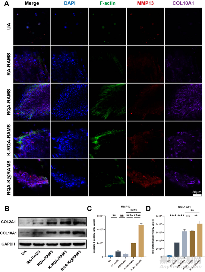 功能化微支架水凝膠復(fù)合體系通過軟骨內(nèi)骨化路徑加速修復(fù)骨軟骨缺損