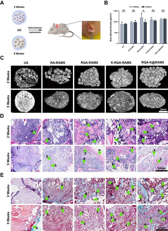 功能化微支架水凝膠復(fù)合體系通過軟骨內(nèi)骨化路徑加速修復(fù)骨軟骨缺損