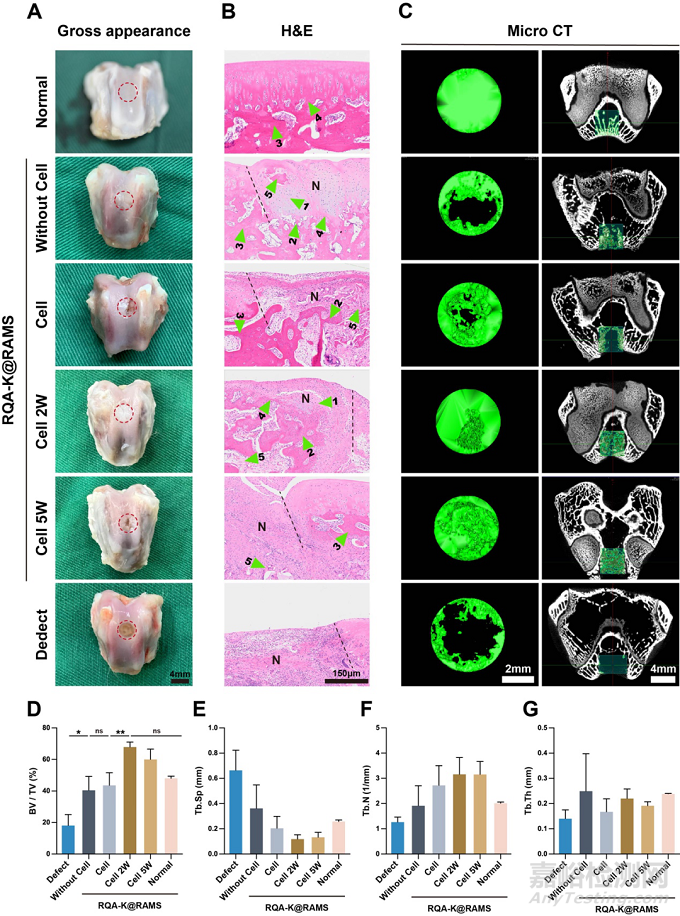 功能化微支架水凝膠復(fù)合體系通過軟骨內(nèi)骨化路徑加速修復(fù)骨軟骨缺損
