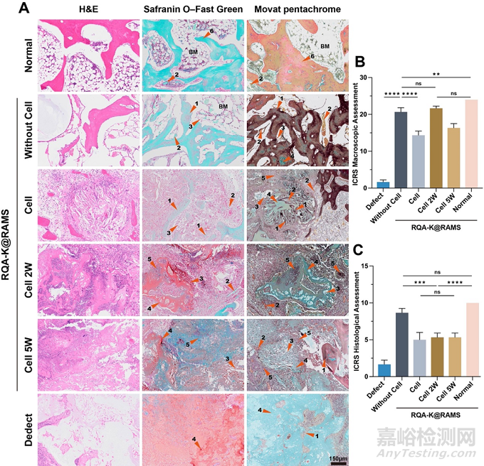 功能化微支架水凝膠復(fù)合體系通過軟骨內(nèi)骨化路徑加速修復(fù)骨軟骨缺損