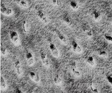 牙科用磷酸酸蝕劑注冊審查指導(dǎo)原則正式發(fā)布（附全文）