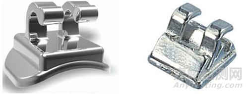 正畸托槽注冊(cè)審查指導(dǎo)原則正式發(fā)布（附全文）