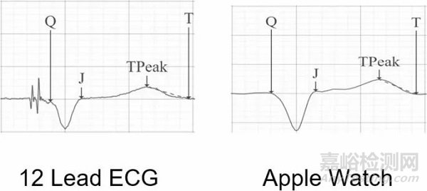 智能手表可利用AI技術(shù)通過心電信號診斷心衰