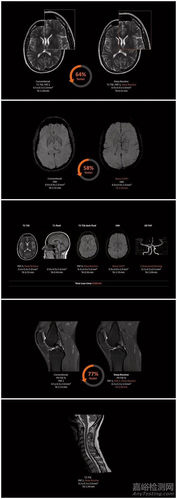 西門子醫(yī)療推出可移動(dòng)磁共振