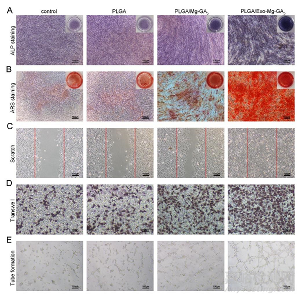 具有成骨、血管生成和抗炎特性的外泌體功能化鎂有機框架支架可加速骨再生