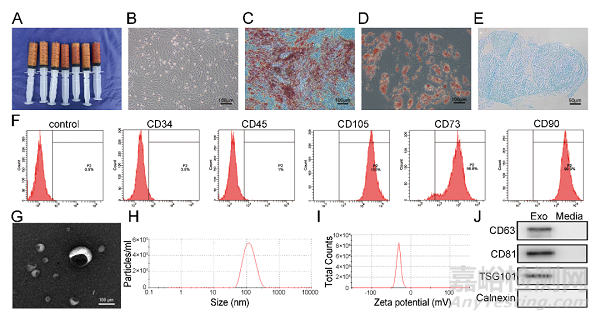 具有成骨、血管生成和抗炎特性的外泌體功能化鎂有機框架支架可加速骨再生
