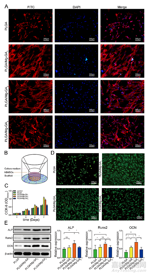 具有成骨、血管生成和抗炎特性的外泌體功能化鎂有機框架支架可加速骨再生