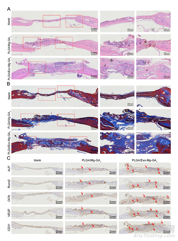 具有成骨、血管生成和抗炎特性的外泌體功能化鎂有機框架支架可加速骨再生
