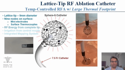 Sphere-9：美敦力電脈沖、射頻、標(biāo)測三合一導(dǎo)管完成IDE研究入組