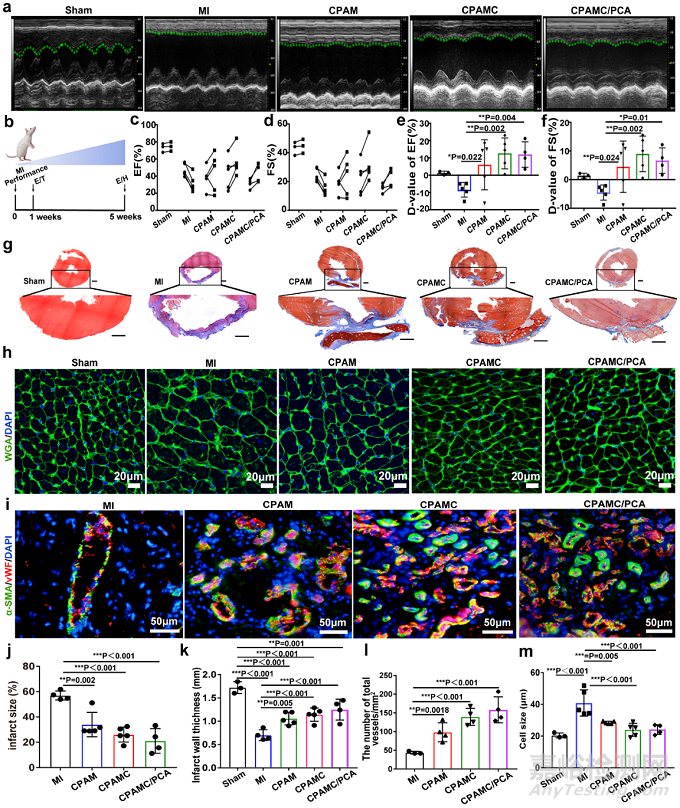 一種用于非侵入性心肌修復和防止術(shù)后組織粘連的智能黏附性Janus水凝膠
