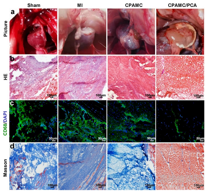一種用于非侵入性心肌修復和防止術(shù)后組織粘連的智能黏附性Janus水凝膠