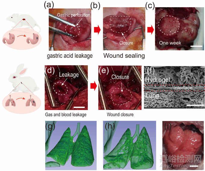 用于胃穿孔和創(chuàng)傷性氣胸快速封閉的高強(qiáng)絲素蛋白基粘合劑